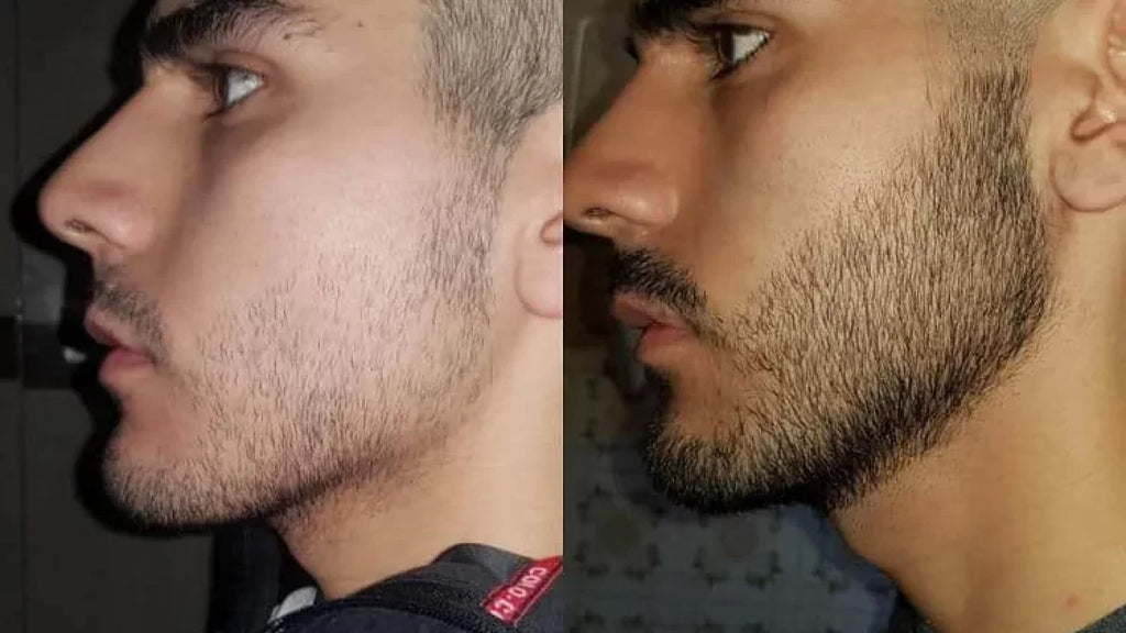 Hairly’s The GroStick: All Natural Hair Growth Roller