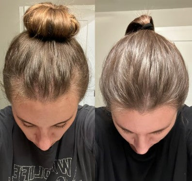 Hairly’s The GroStick: All Natural Hair Growth Roller