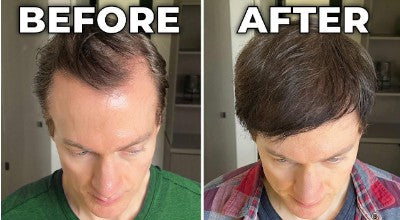 Hairly’s The GroStick: All Natural Hair Growth Roller